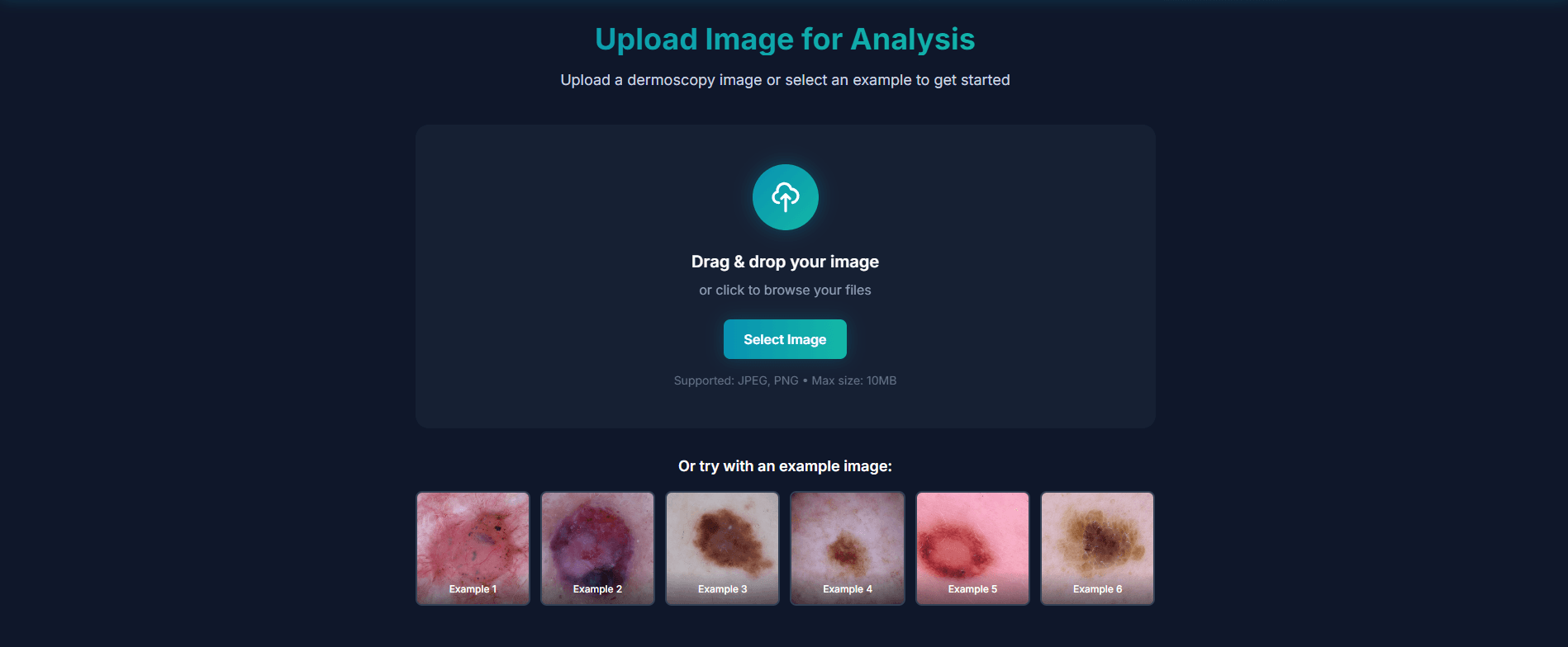 Image upload & example dermoscopy images